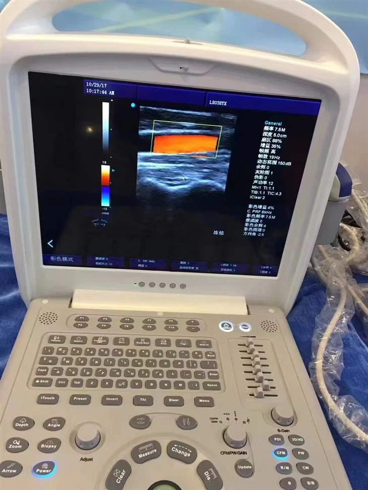 Surgical Medical Full Digital Color Doppler Ultrasound System